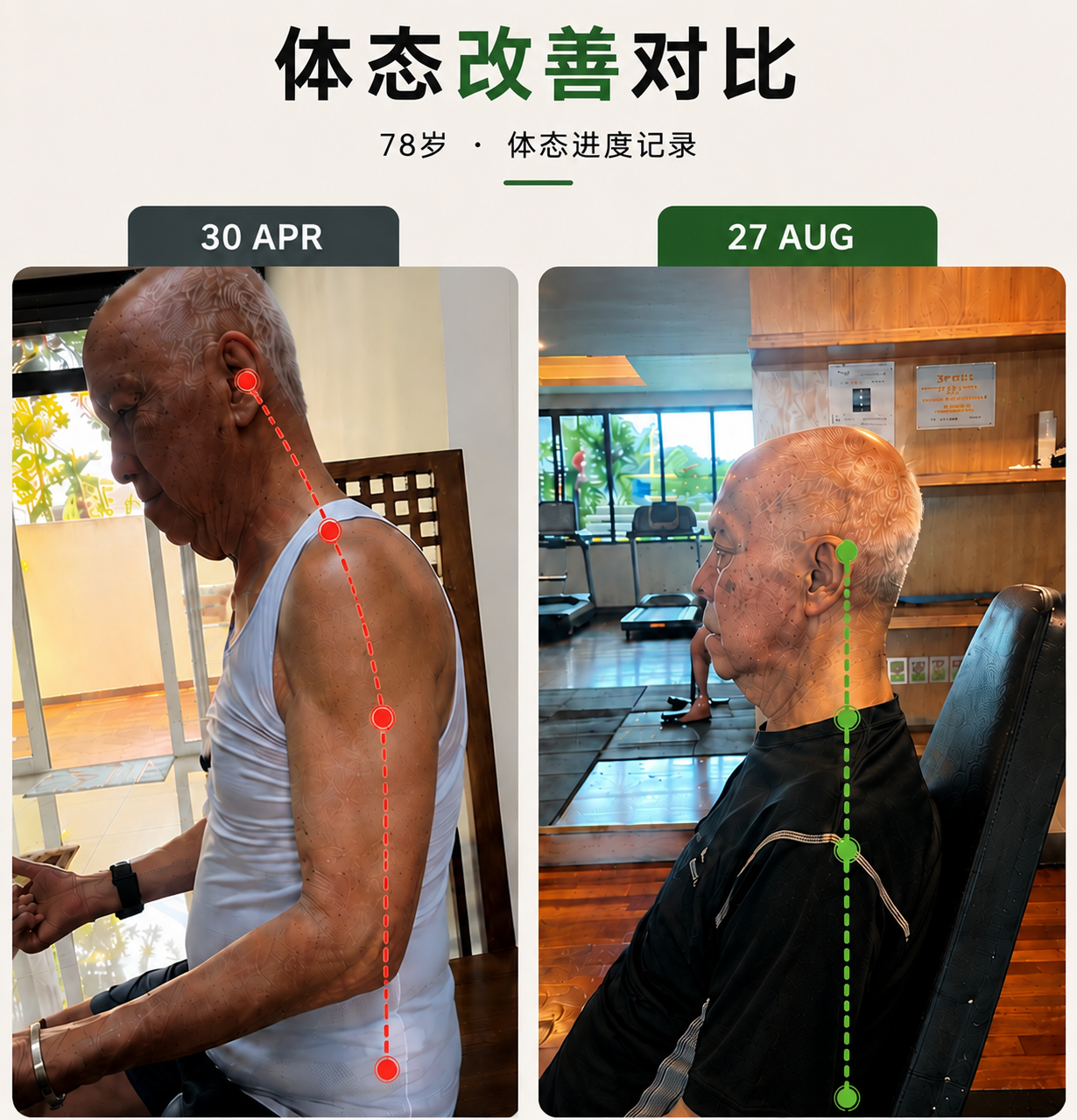 Posture progress comparison for a 78-year-old Ascenity student from 30 April to 27 August